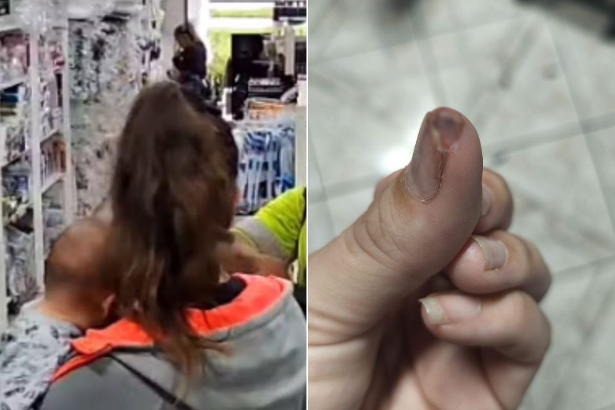 Mulher agredida por assaltante enquanto amamentava filho teve parte do dedo arrancada com mordida