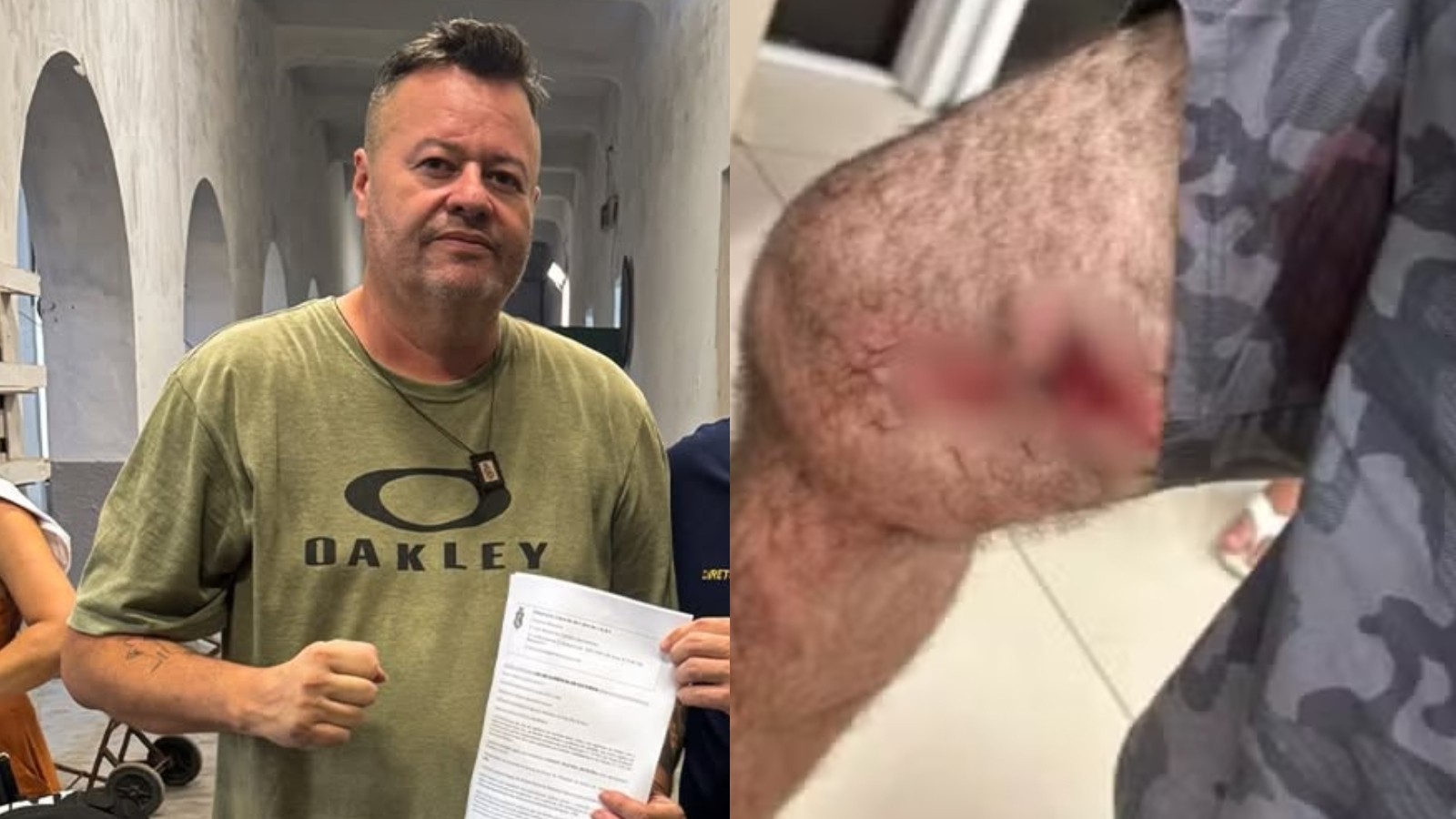 Policial é solto após confusão em que foi baleado e deixou homem ferido na Grande Fortaleza