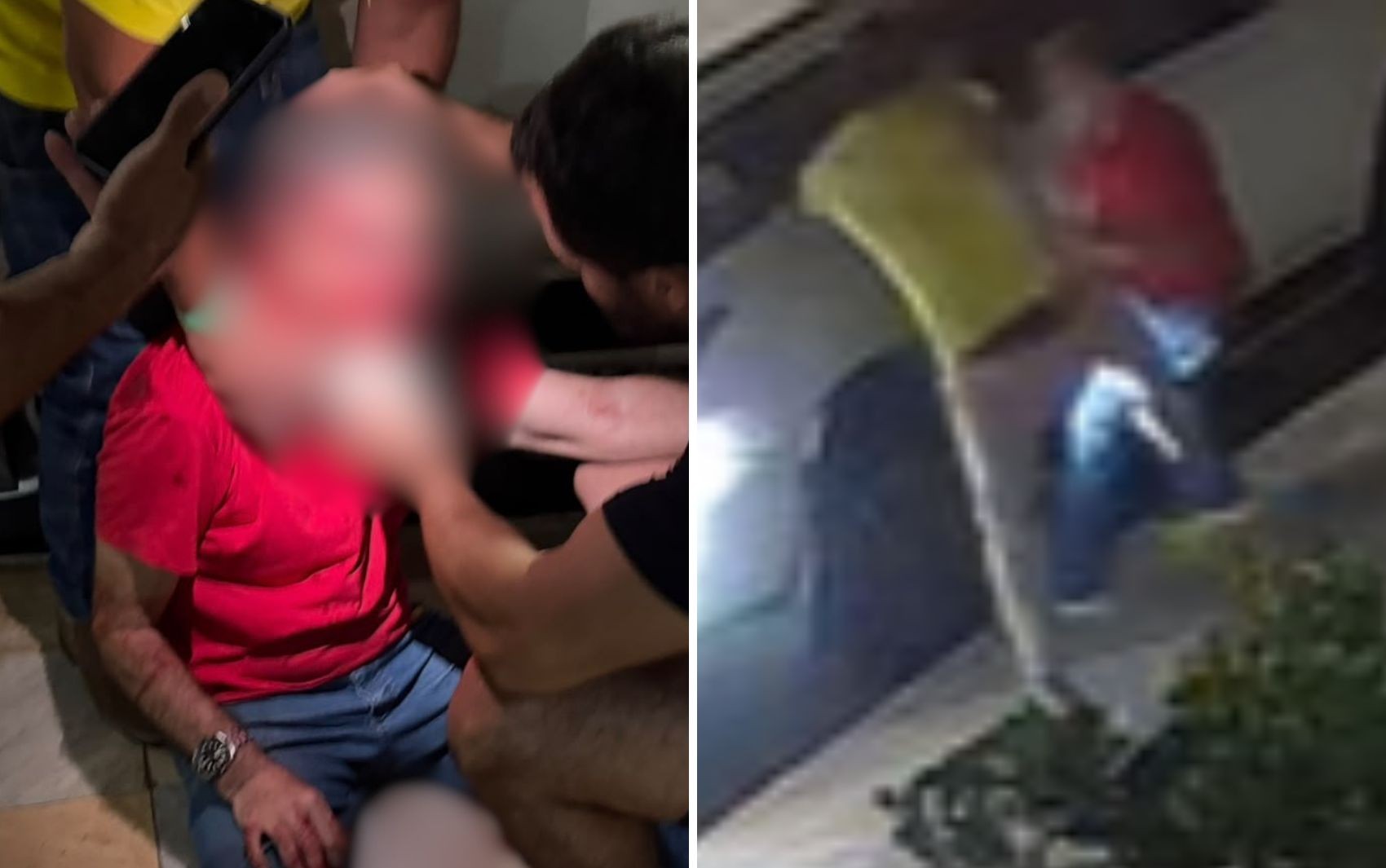 'Brutalmente agredido' — Família de pastor atacado ao usar camiseta vermelha após vitória de Lula diz que ato foi de 'extrema violência'