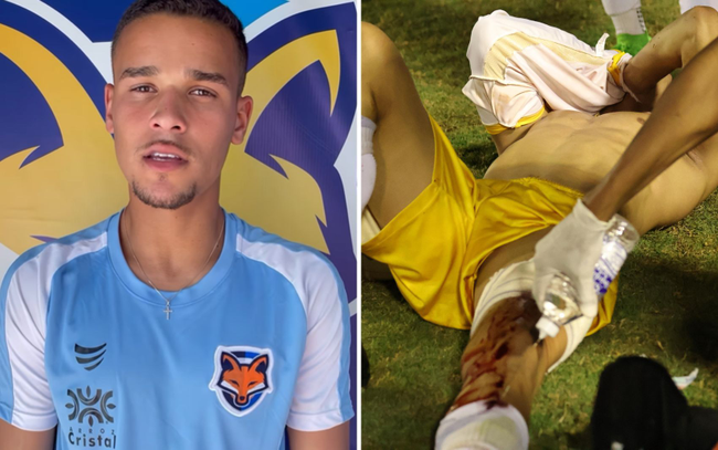 Goleiro baleado por policial aps jogo diz que est abalado psicologicamente