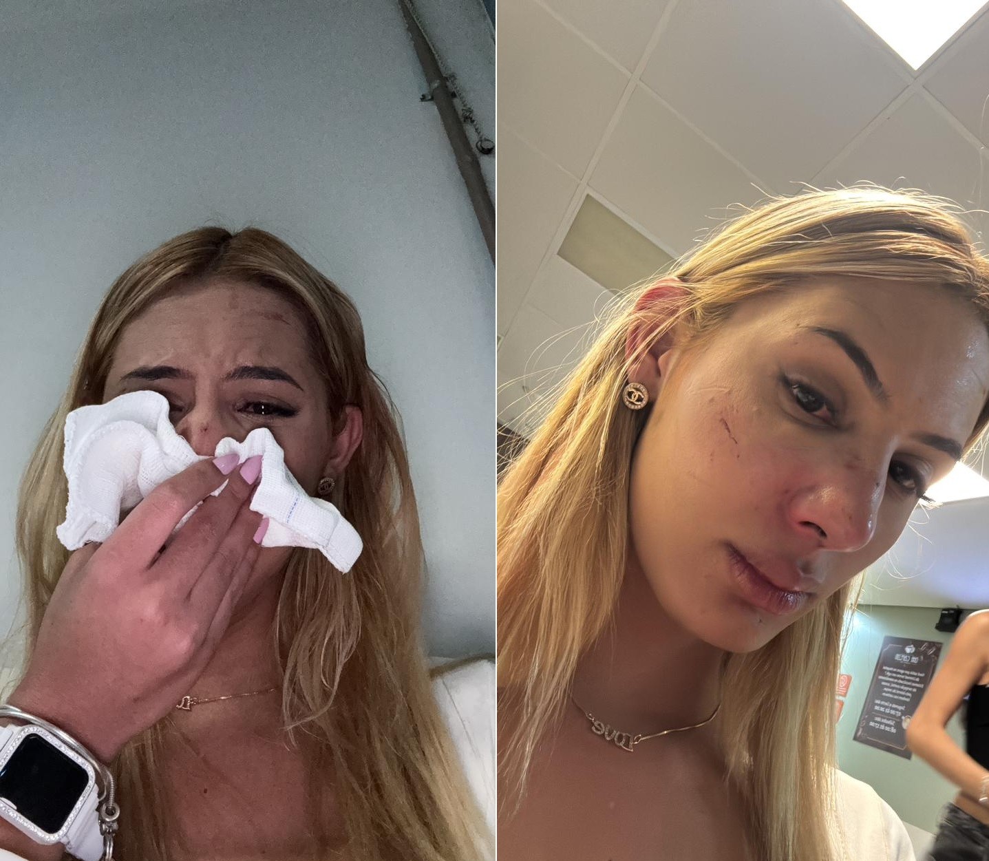 Jovem trans é agredida com soco no nariz e afirma ter sido vítima de transfobia no interior de SP