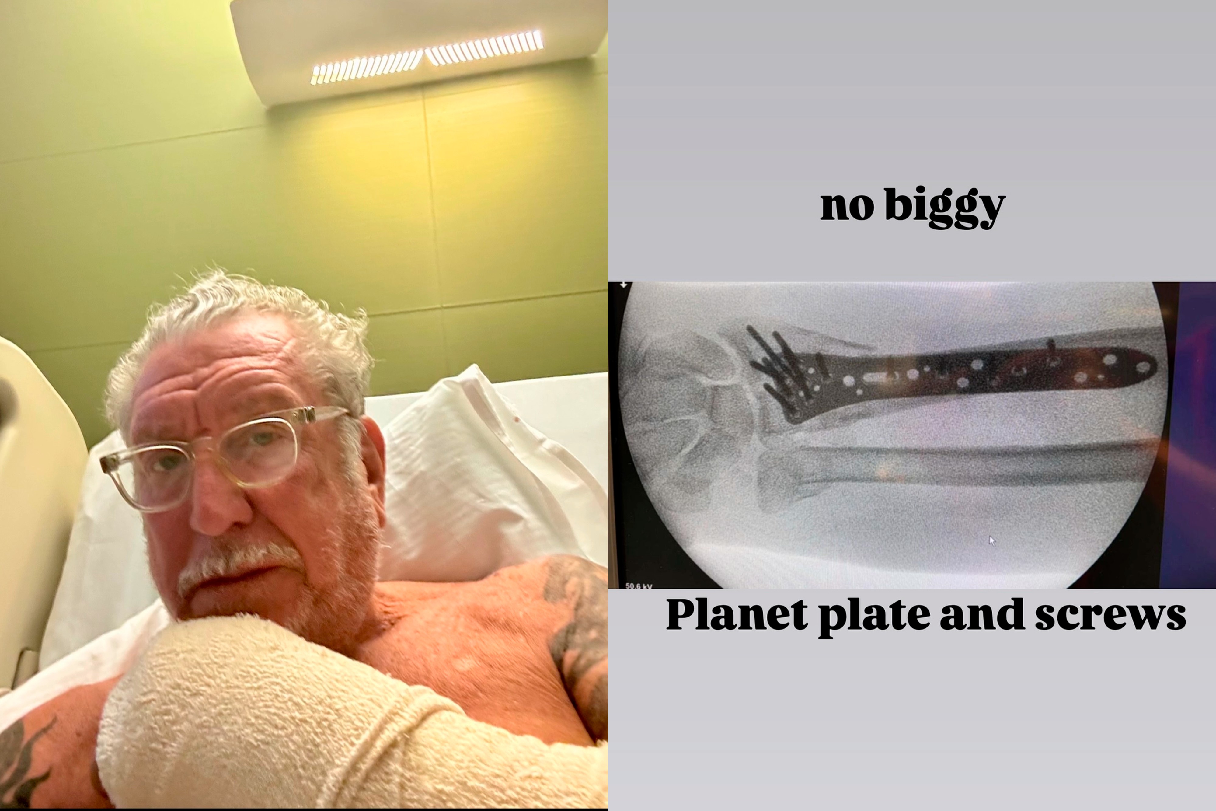 Sex Pistols: Guitarrista quebra o pulso e cancela show no The Town