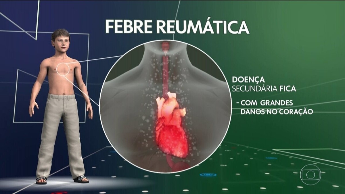 Pesquisadores de SP criam vacina que pode evitar febre reumática ...