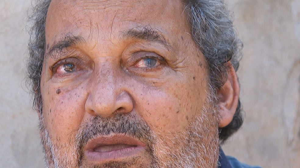 O pintor Carlos Augusto Rinaldi perdeu a visão do olho esquerdo após passar por cirurgia de catarata no AME de Taquaritinga, SP — Foto: Valdinei Malaguti/EPTV