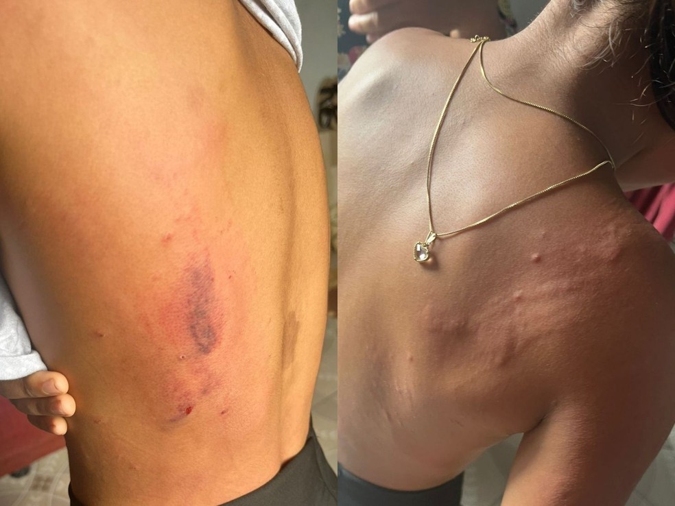 Irmã do adolescente também já sofreu agressões praticadas pelo pai — Foto: Arquivo pessoal