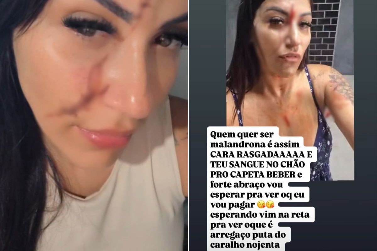 Mulher agride cabeleireira com pedaço de vidro e debocha da vítima nas redes sociais: 'cara rasgada'