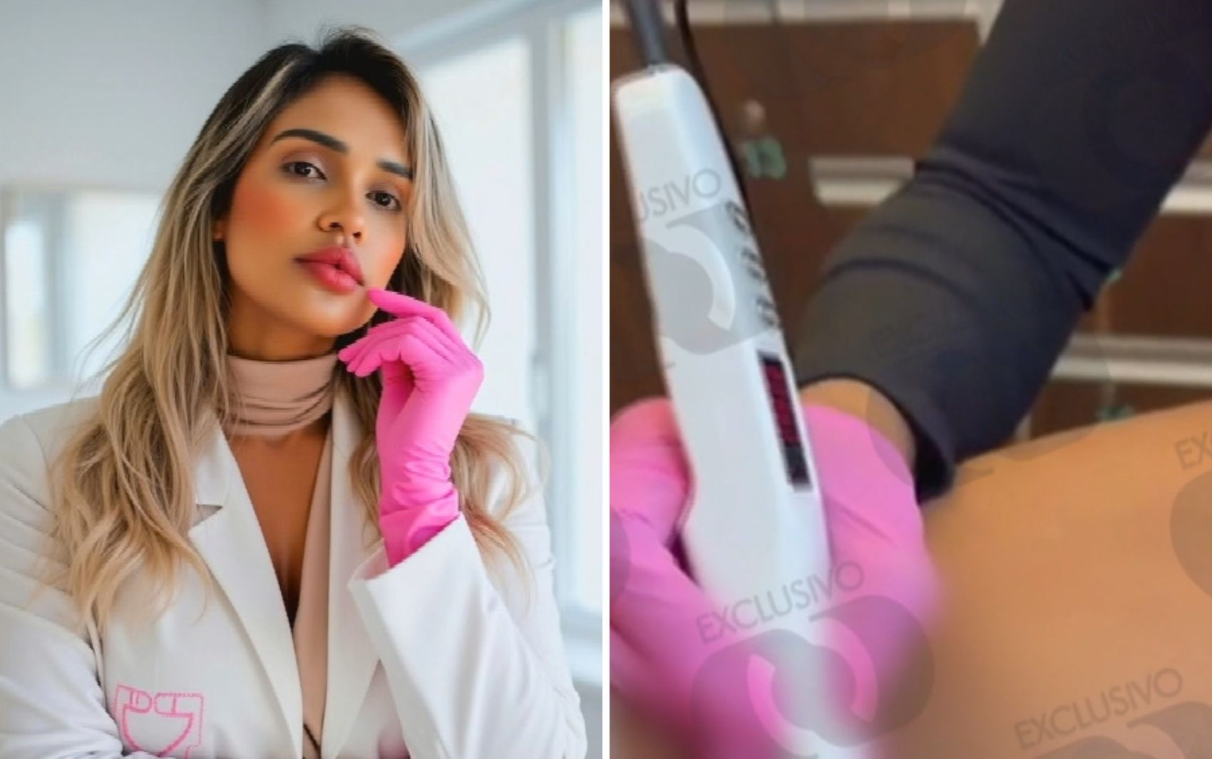 Fisioterapeuta presa suspeita de mutilar pacientes: vídeo mostra quando ela usa guardanapo para limpar corte de paciente, diz PC