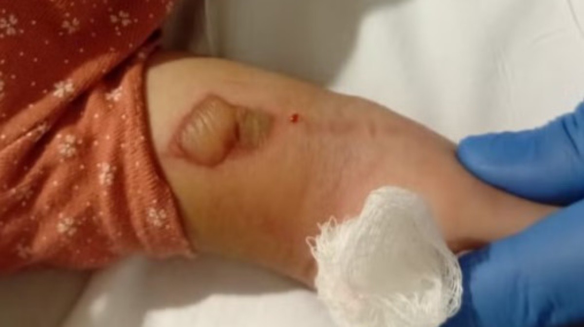 Polícia investiga morte de bebê em hospital de Niterói, e família diz que medicação foi trocada: ' Nome da outra criança'