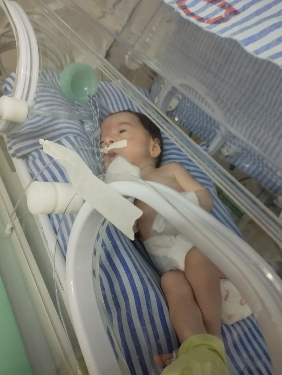 Mesmo com ordem judicial, recém-nascido espera há 22 dias por UTI em hospital de Belém: ‘Quero que meu filho tenha chance de viver’