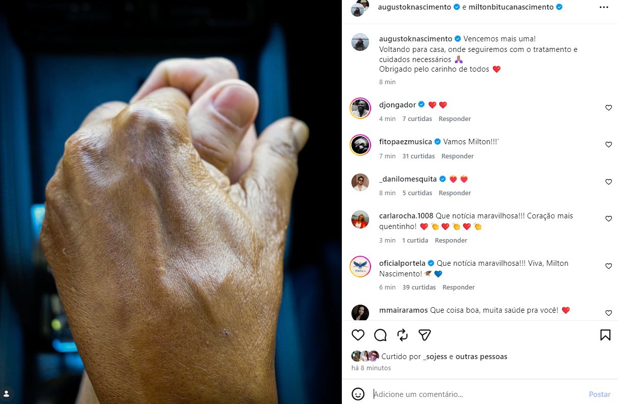 Milton Nascimento tem alta após pneumonia e agradece apoio dos fãs