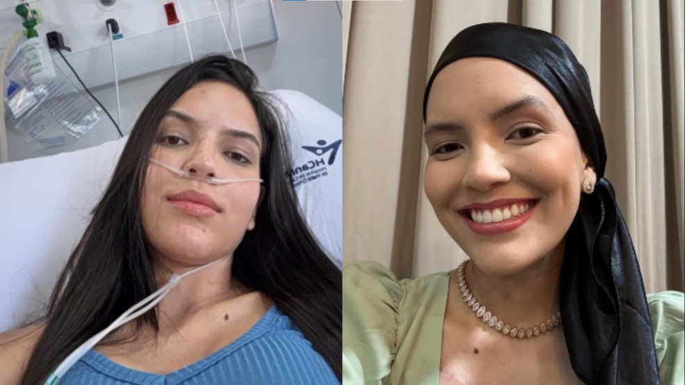 Advogada Nathaly Resende, de 25 anos recebeu alta da quimioterapia em Cuiabá — Foto: Nathaly Resende/Arquivo Pessoal