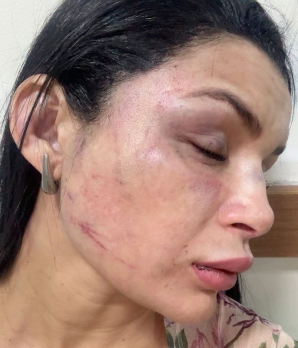 Corretora e musa da Aparecida denuncia agressão por motorista de aplicativo durante corrida em Manaus. — Foto: Reprodução/Redes Sociais