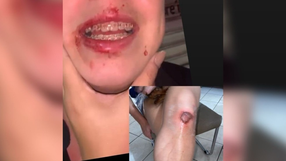 DJ é agredida por policial ao defender amiga que sofria assédio em festa de carnaval — Foto: Arquivo pessoal