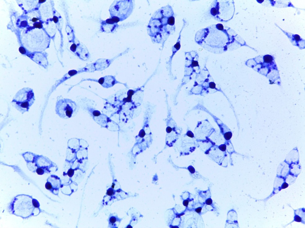 Células do sistema imune infectadas com a cepa de Leishmania amazonensis resistente à anfotericina B — Foto: Elizabeth Magiolo Coser e Bianca Alves Ferreira/Unicamp