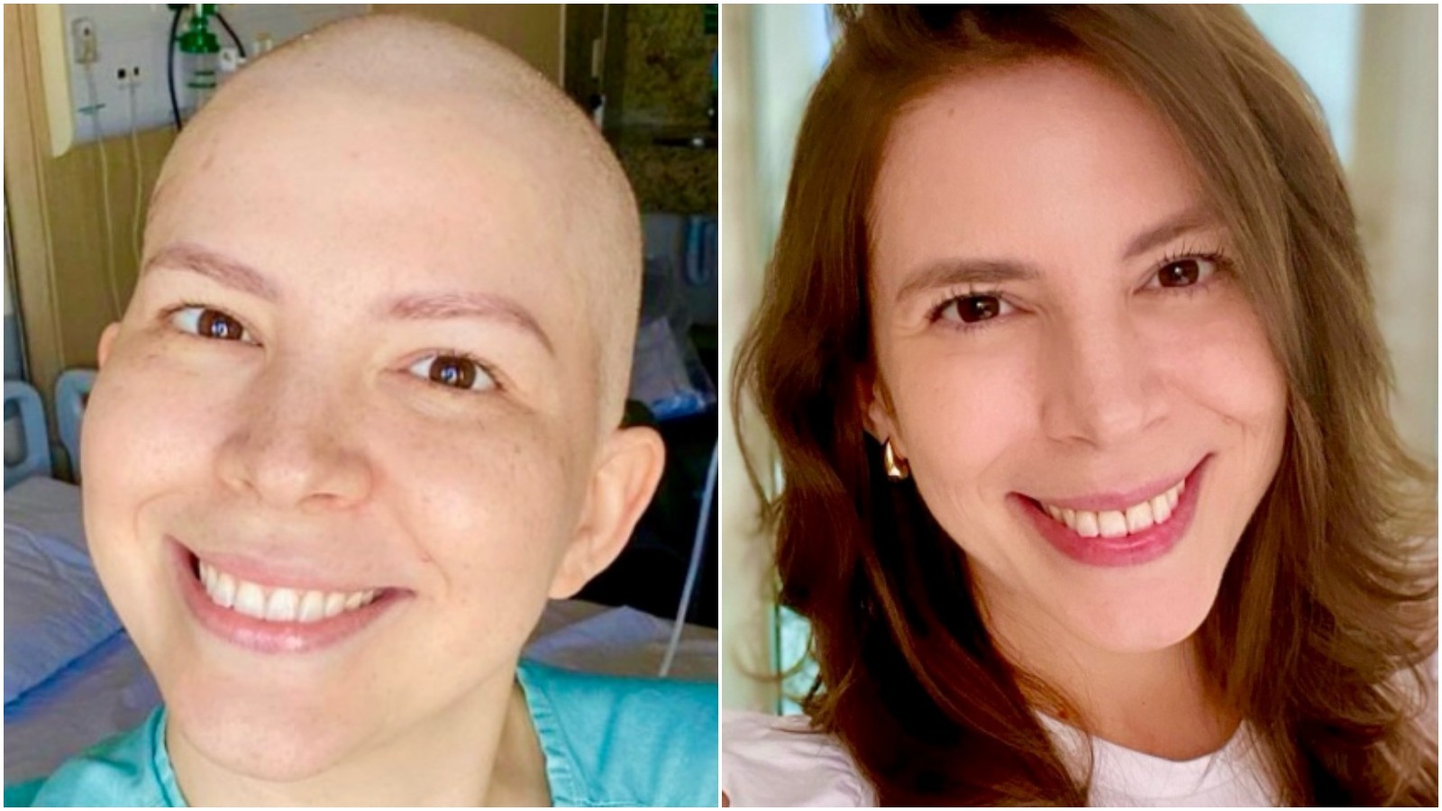 Marina Alves retoma trabalho na TV Verdes Mores quatro anos após diagnóstico de câncer