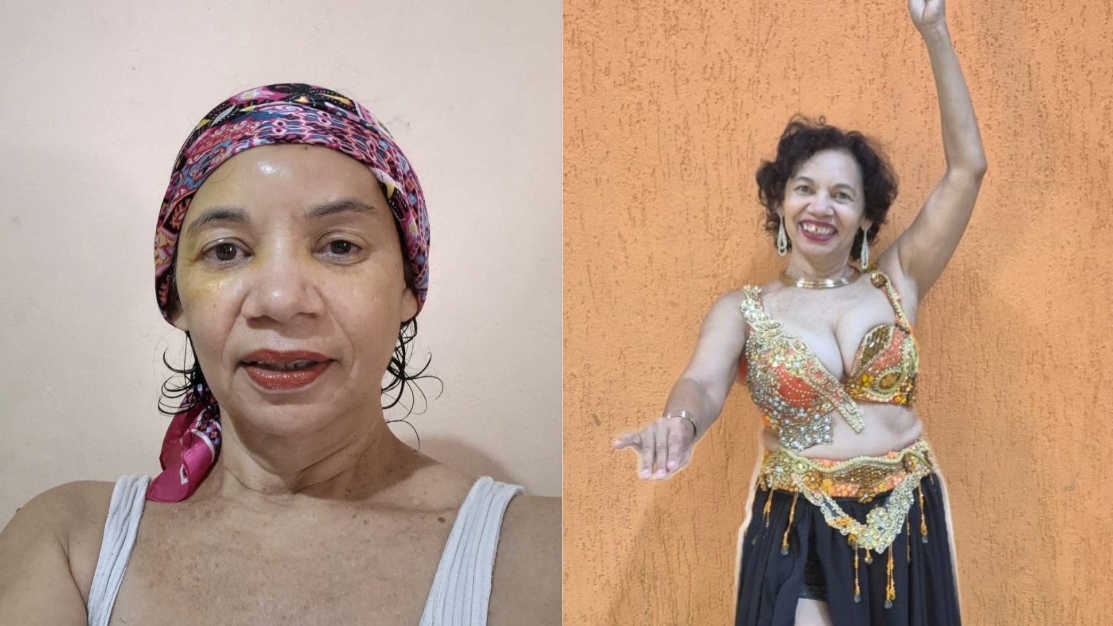 Mulher que venceu câncer de mama encara novo diagnóstico após 12 anos: ‘Quero viver’
