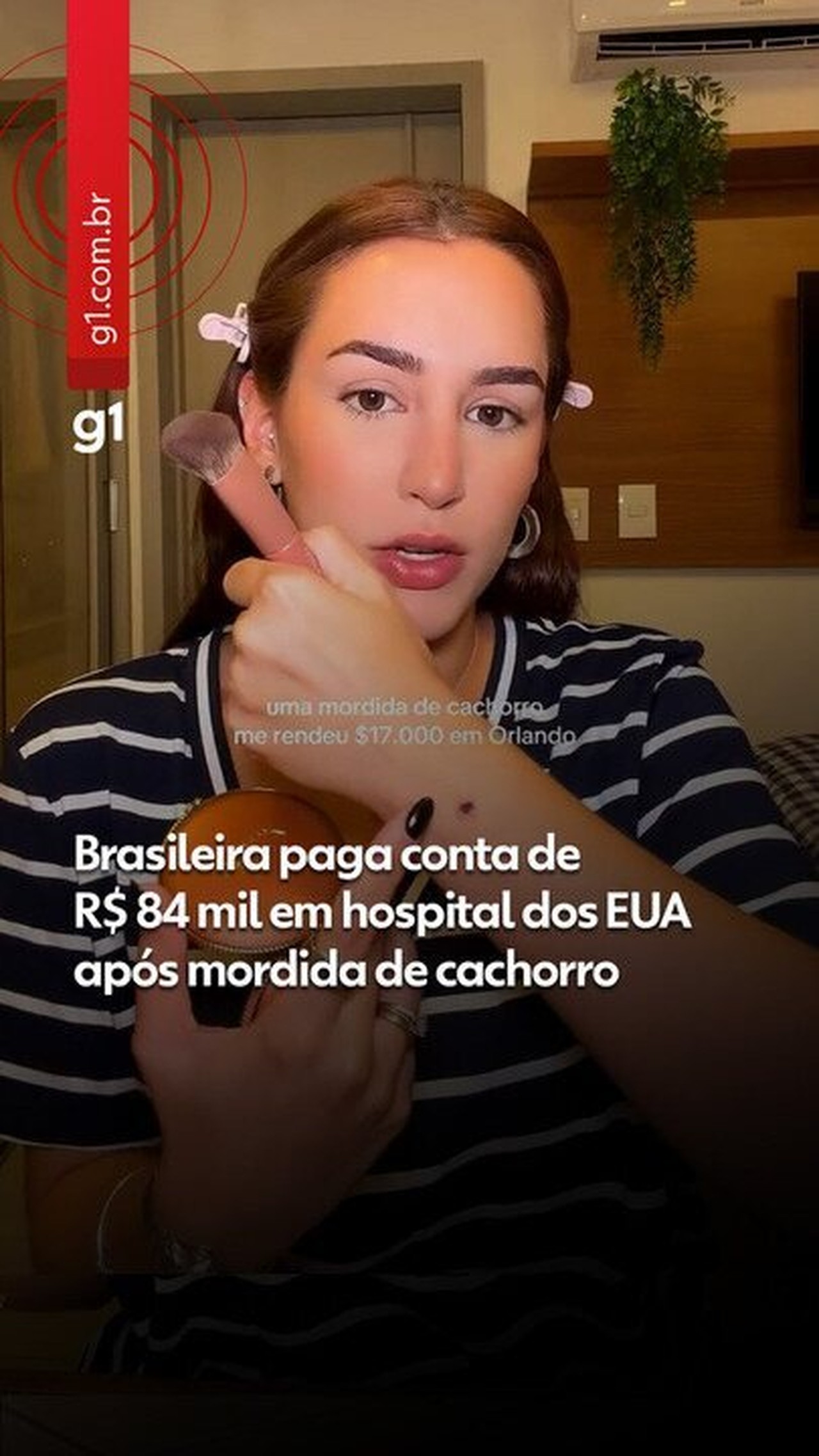 Brasileira choca ao revelar conta de R$ 84 mil em hospital dos EUA após mordida de cachorro