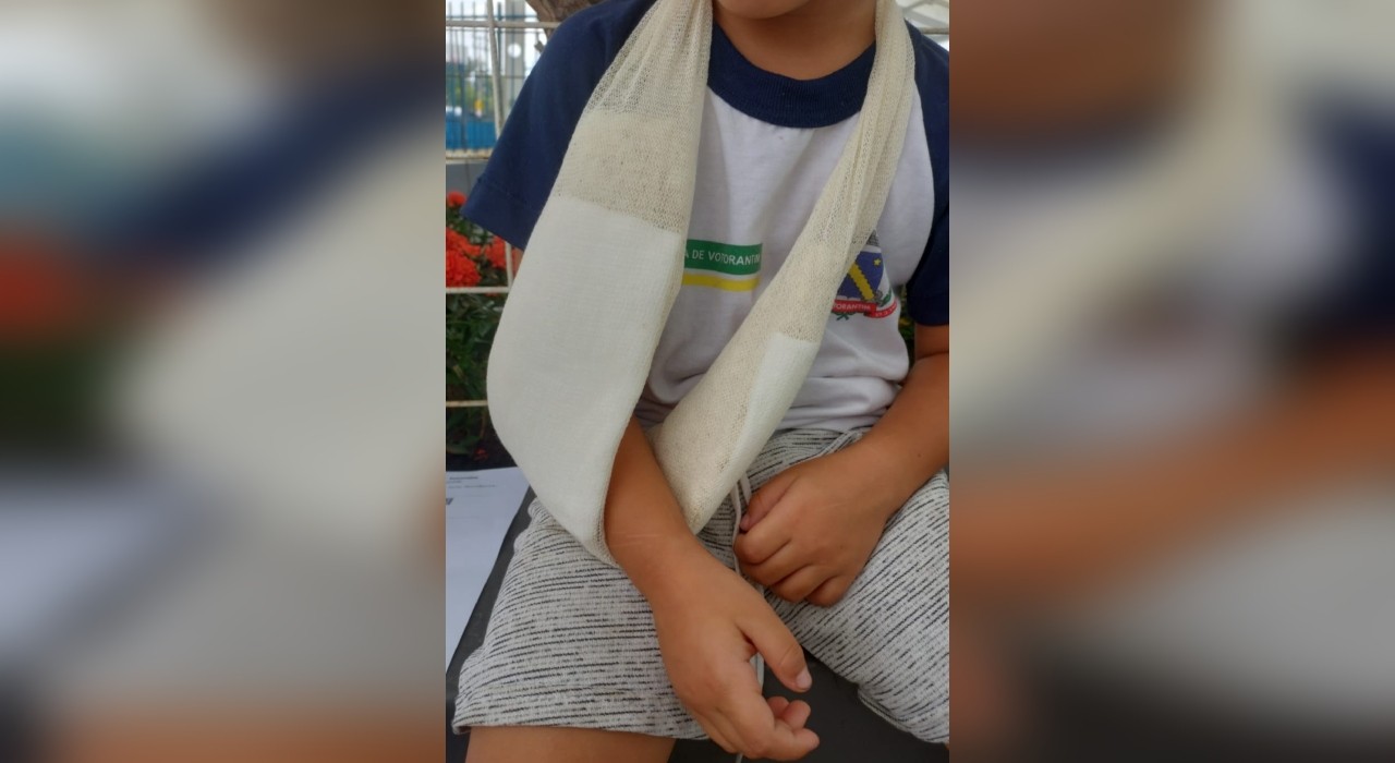 Mãe denuncia creche após janela quebrar e cair em cima do filho dela em Votorantim