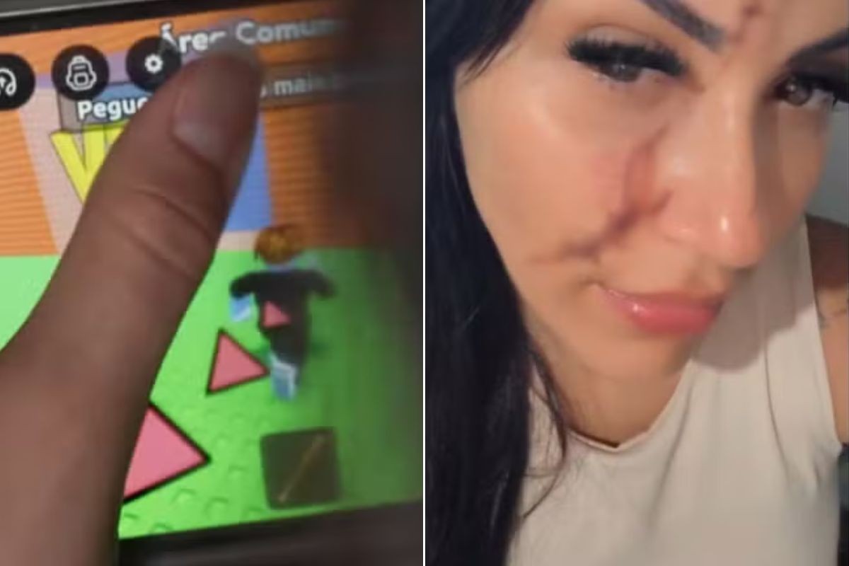 Mãe tem rosto cortado por vidro ao tentar resolver conflito dos filhos no jogo Roblox