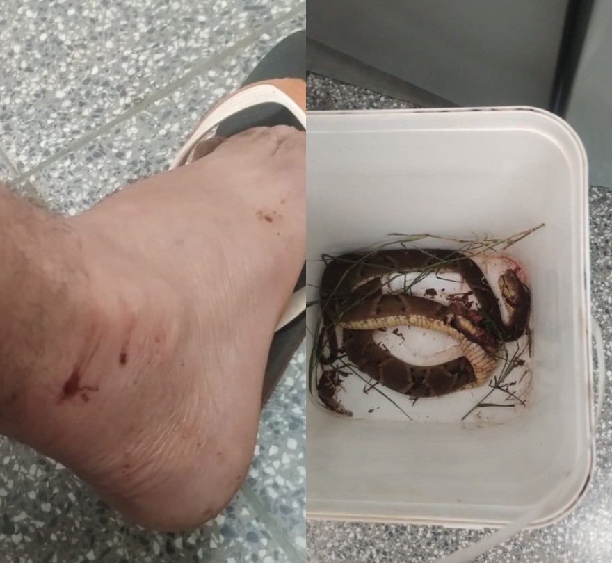 Trabalhador é picado por jararaca durante almoço e leva serpente dentro de balde para o hospital em MS