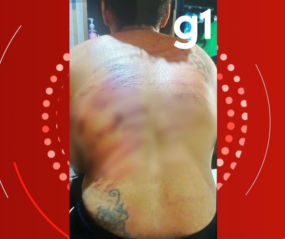 Jovem sequestrada é resgatada pela 2ª vez após ser torturada com 50 chibatadas em MT