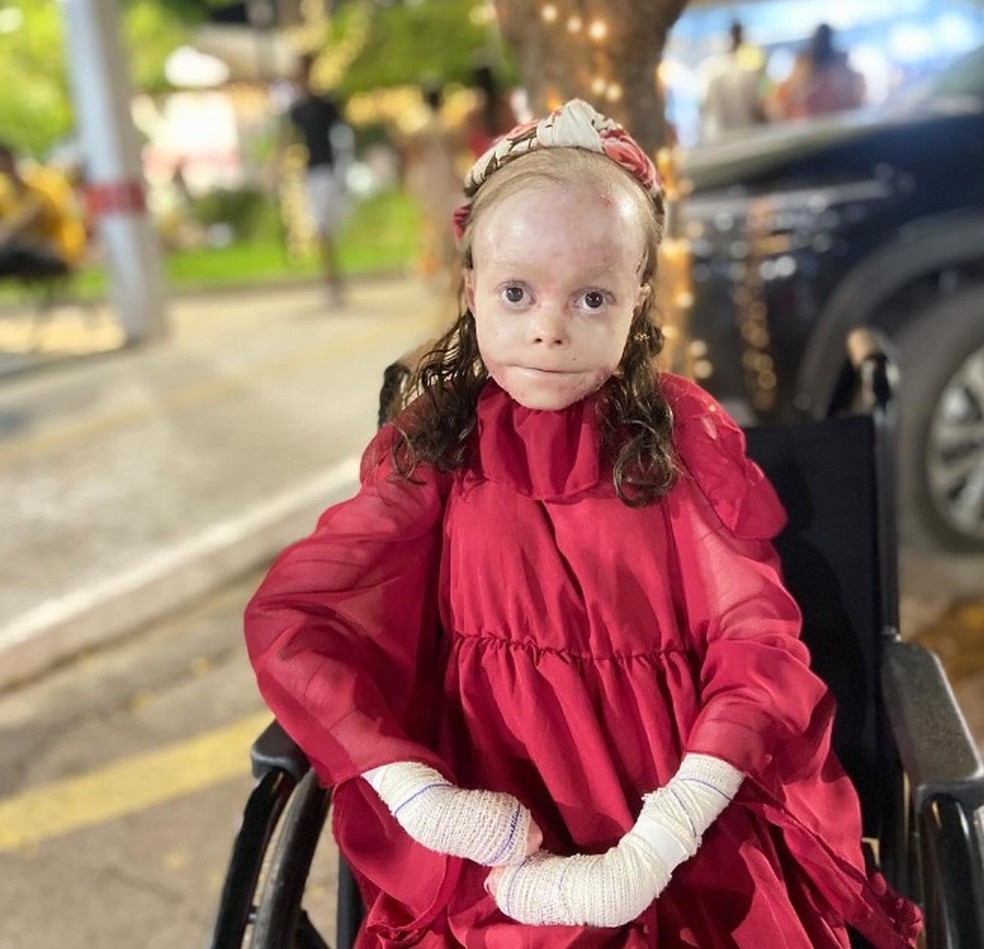 Morre aos 31 anos, Dai Cruz, influenciadora digital baiana que sofria de Epidermólise Bolhosa — Foto: Reprodução/Redes Sociais