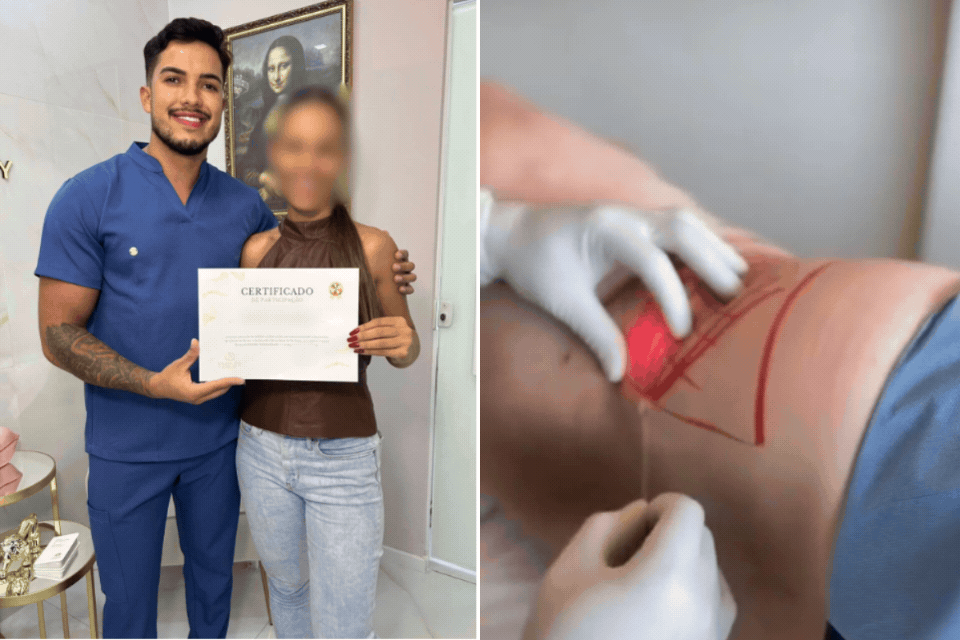 Falso médico é preso após realizar procedimentos estéticos invasivos no litoral de SP 