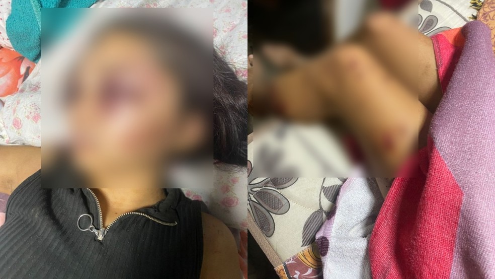 Adolescente é sequestrada e tem rosto desfigurado após agressões de namorado no Ceará. — Foto: Reprodução