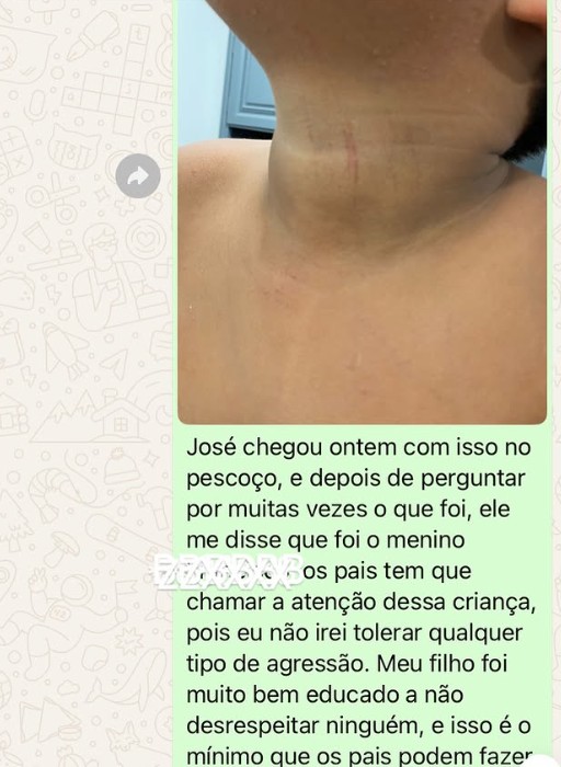 'Podia ter acontecido com qualquer menino', justificou a professora da criança brasileira que teve dedos decepados em escola de Portugal