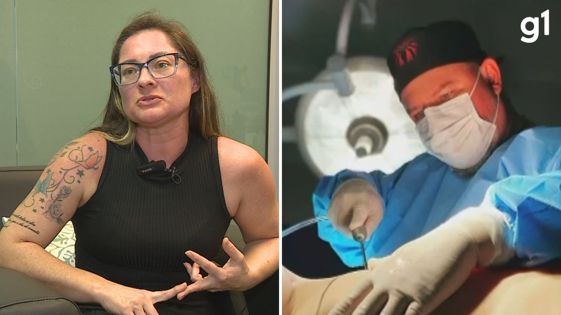 Mulher teve intestino perfurado e ficou em coma após operação com cirurgião plástico acusado de crimes: 'Cicatrizes por todo o corpo'