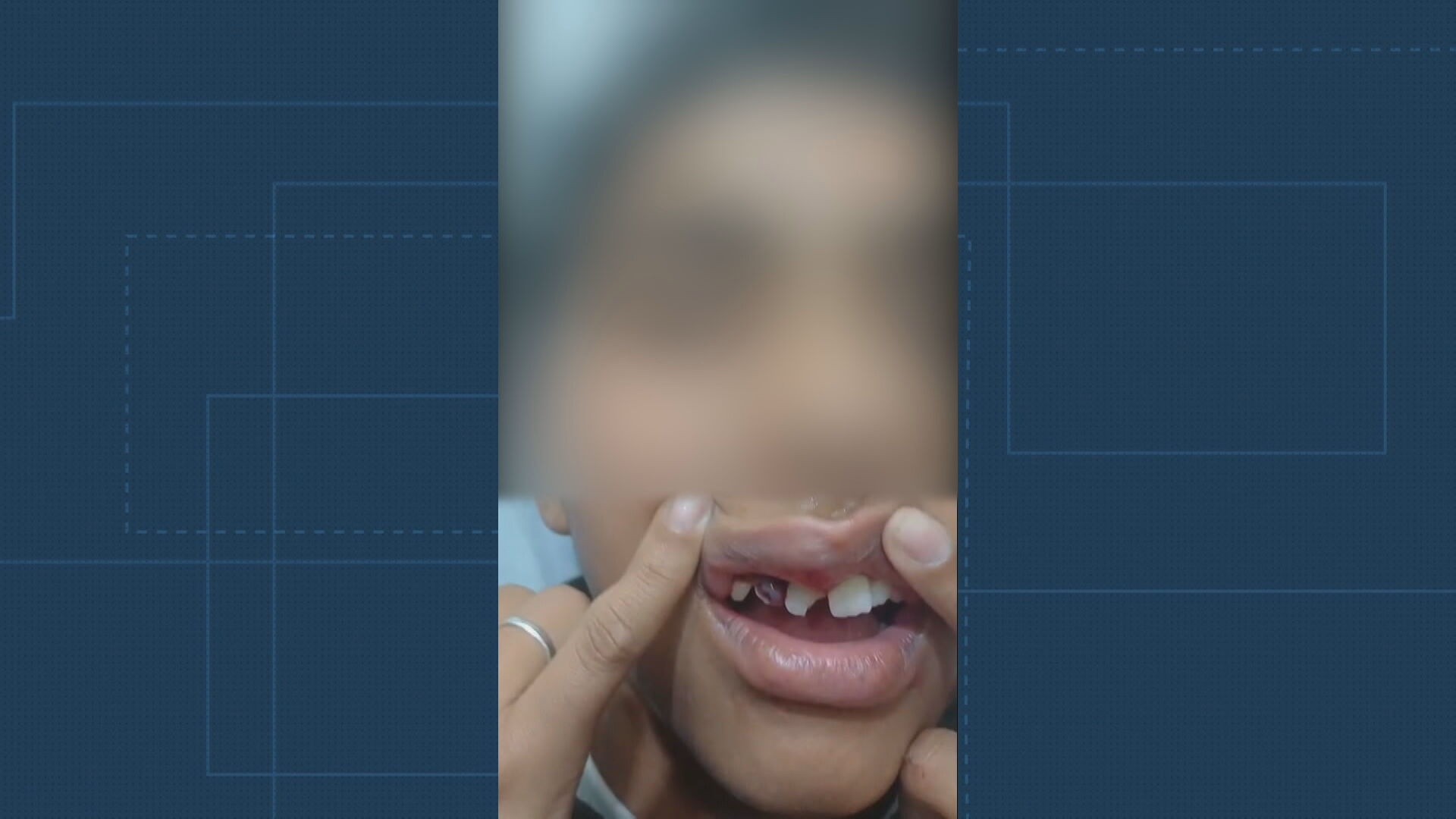 Em 6 meses, dois alunos da rede municipal do Rio foram hospitalizados após casos de bullying