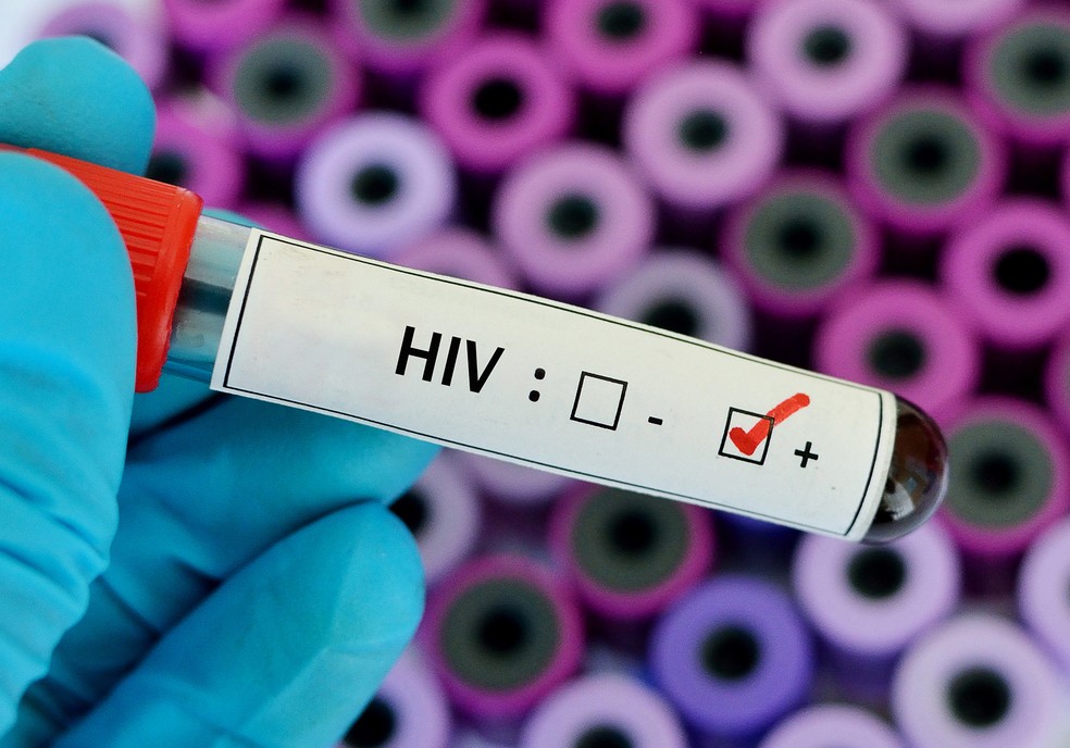 O termo HIV é usado para se referir ao vírus da imunodeficiência humana. Já AIDS significa síndrome da imunodeficiência adquirida. — Foto: shutterstock