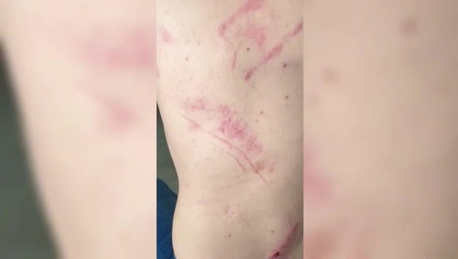 Empresário fica ferido após ser agredido por PM e seguranças