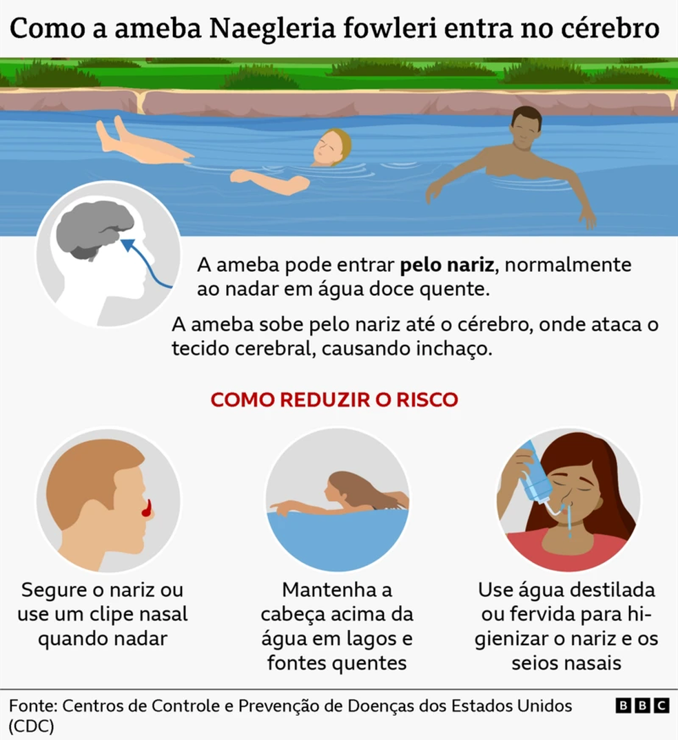 Como a ameba entra no cérebro — Foto: BBC