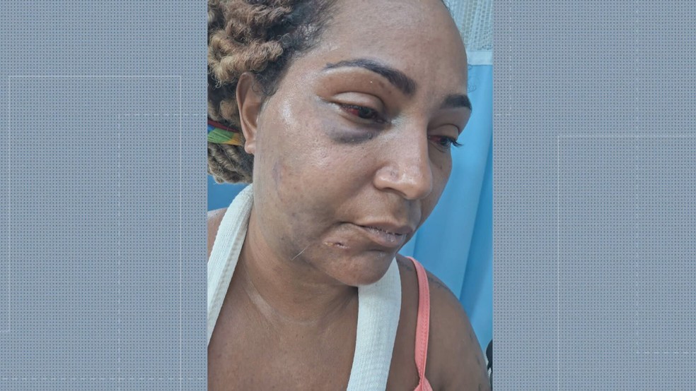 Família conta que Carla Meireles foi torturada pelo ex-companheiro na região central do Rio — Foto: Reprodução/ TV Globo