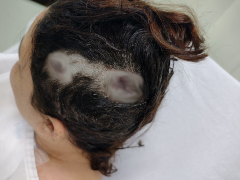 Mulher diz que bala 'entrou e saiu' da cabeça dela após tentativa de feminicídio em Peruíbe (SP) — Foto: Arquivo Pessoal