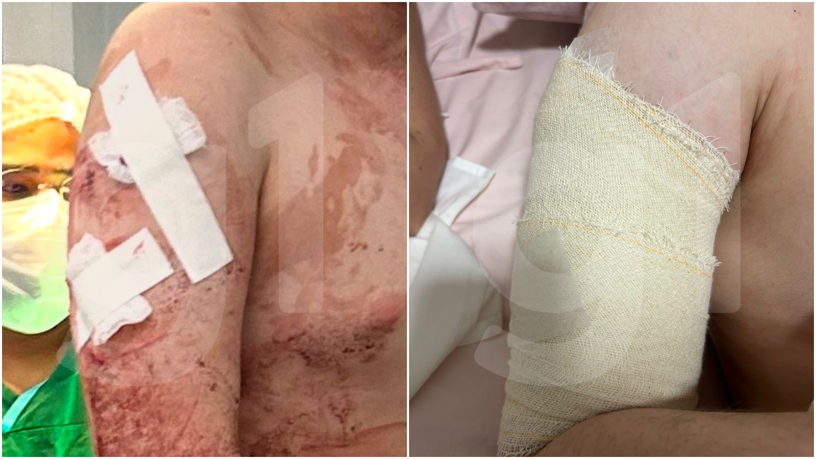 Estudante ferido em ataque em escola no Ceará sofreu 30 pontos pelo corpo e recebeu alta após cirurgia