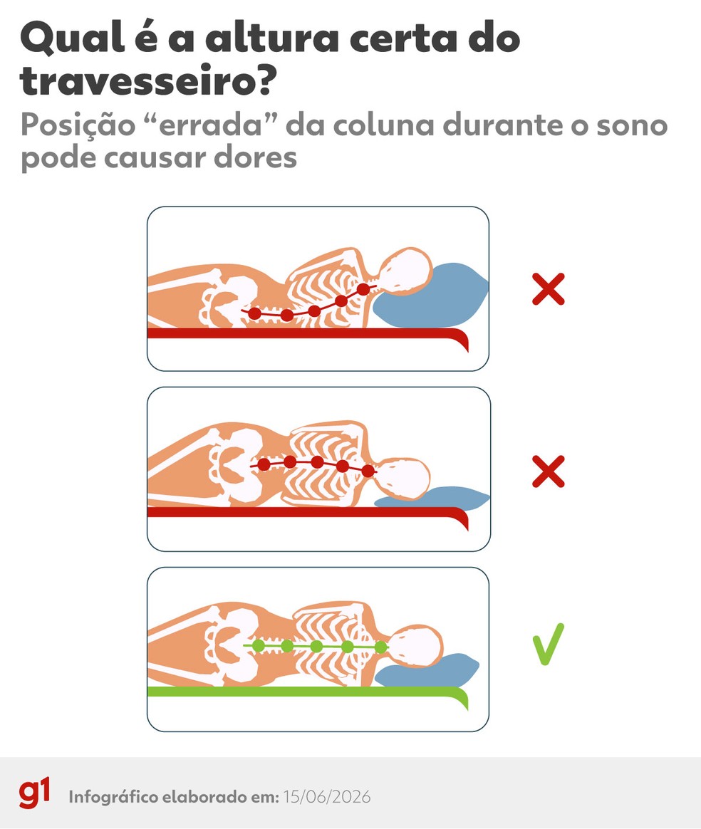 Infogr�fico mostra como identificar se a coluna est� alinhada pela altura do travesseiro. � Foto: Caroline Inoue/g1