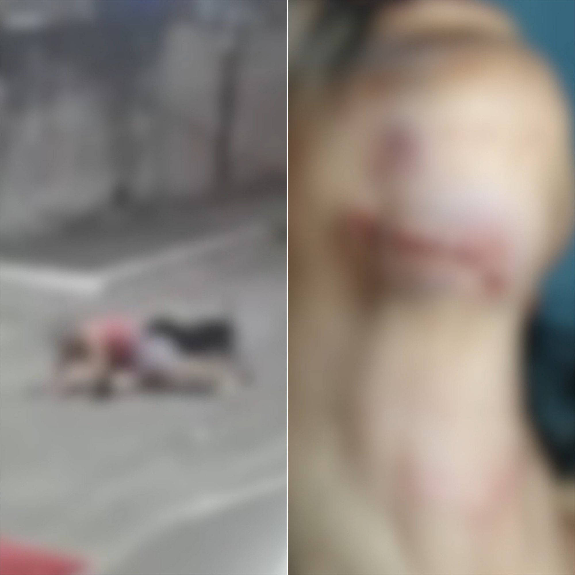 VÍDEO: Mulher fica ferida após ser atacada por dois pitbulls na Grande Natal