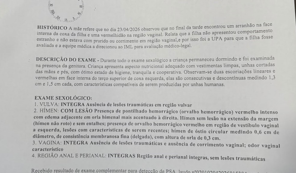 Exame sexológico atestou lesão na região do hímem da criança — Foto: Reprodução/TV Cabo Branco