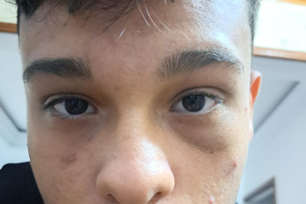 Nicolas Tavares ficou com ferimentos no rosto após se defender de paciente — Foto: Arquivo pessoal