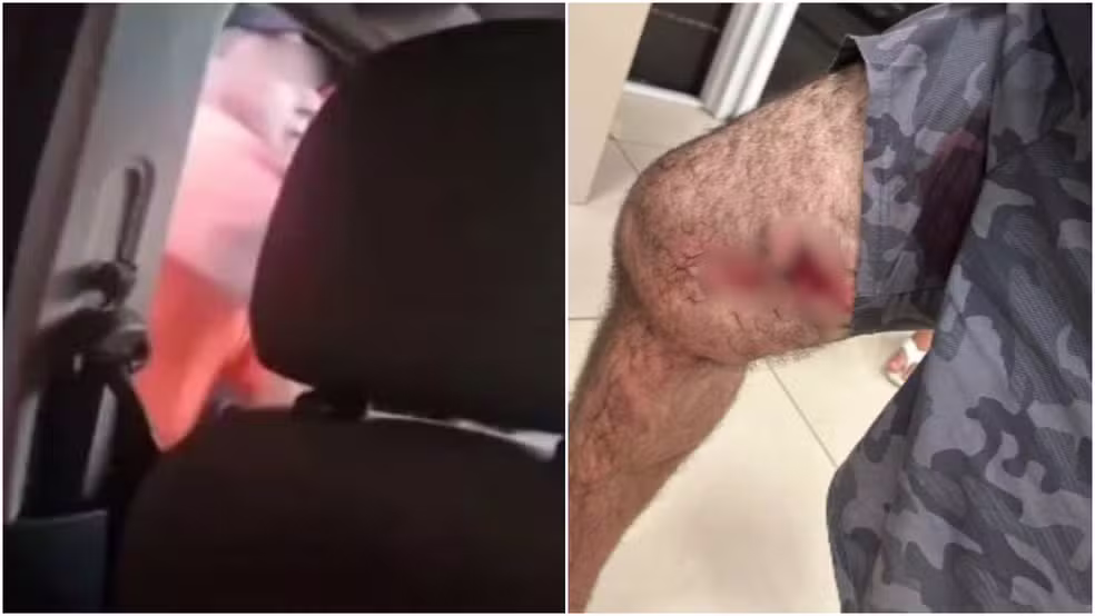 Policial é preso por balear homem durante discussão em Aquiraz. Agente também foi ferido na perna pela própria arma. — Foto: Reprodução