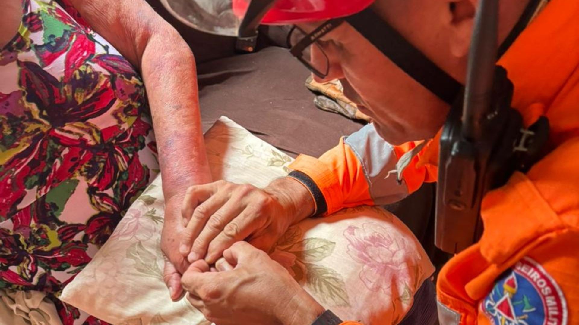 VÍDEO: Chikungunya causa inchaço e leva pacientes a acionar bombeiros por alianças presas em MG