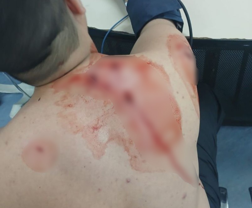 Homem é preso por esfaquear e tentar roubar a moto de um motociclista de aplicativo em Santa Cruz
