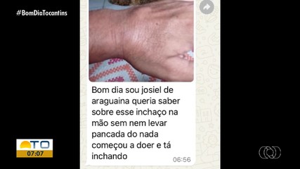 Médico ortopedista tira dúvidas sobre cuidados com a coluna no Bom Dia Responde