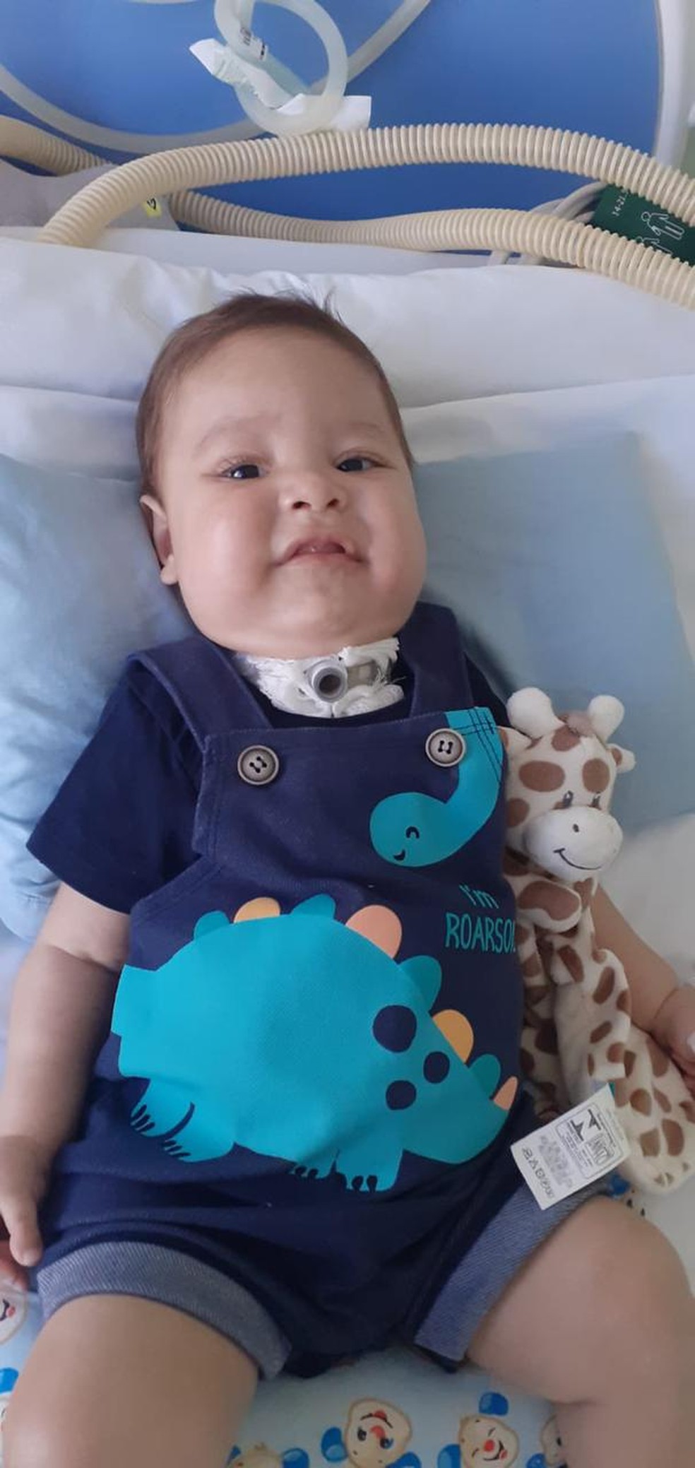 Adrian Emanuel foi diagnosticado com AME quando tinha 4 meses de vida — Foto: Arquivo pessoal