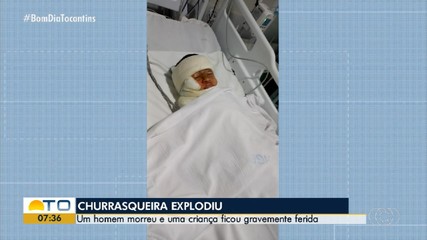 Criança é internada com queimaduras graves após explosão em churrasqueira que matou homem