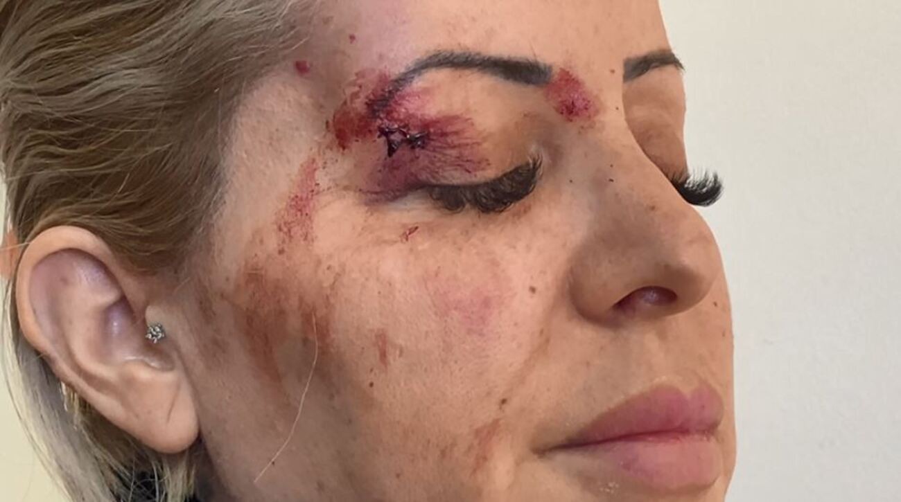 Mãe é suspeita de tentar atropelar adolescente que agrediu o filho em jogo de futebol, diz B.O.