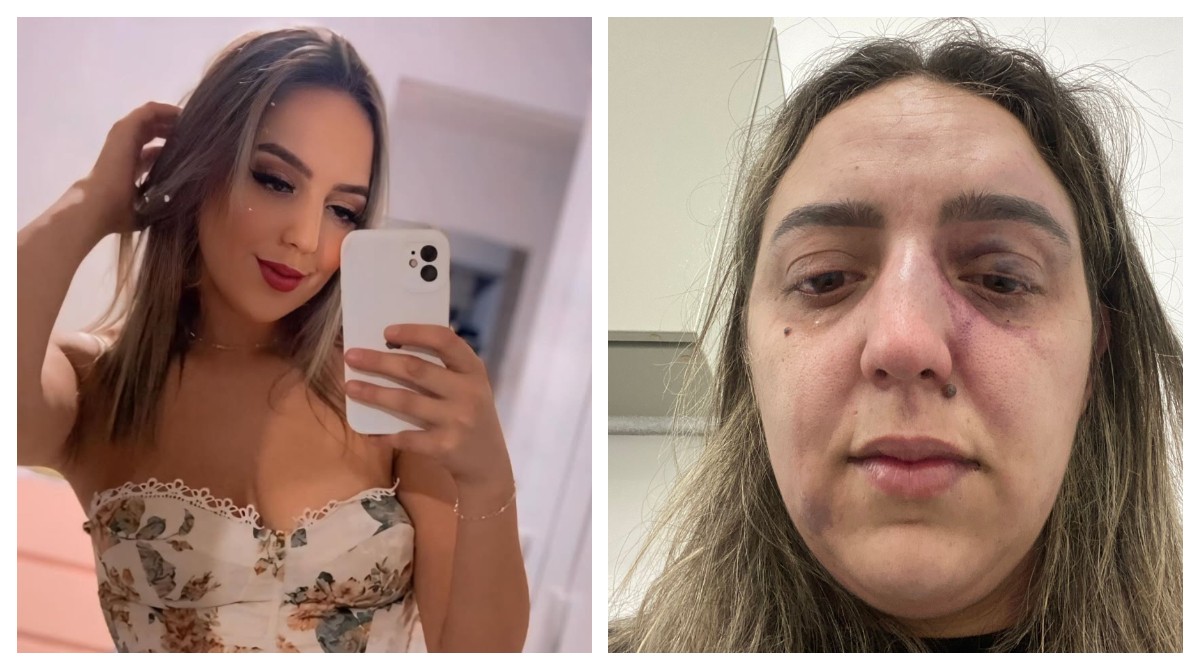 Ex espanca mulher com socos, chutes e pedaço de madeira em posto de gasolina em SP; 'importante é que sobrevivi', diz vítima