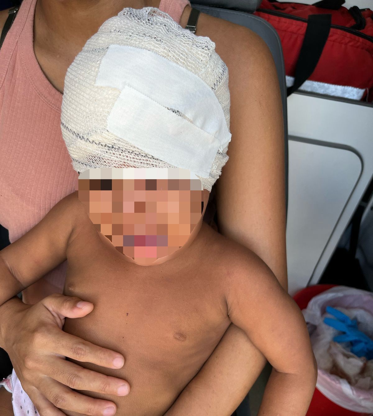 Menina de 2 anos é atingida com pedrada na cabeça durante discussão entre vizinhos em Boa Vista